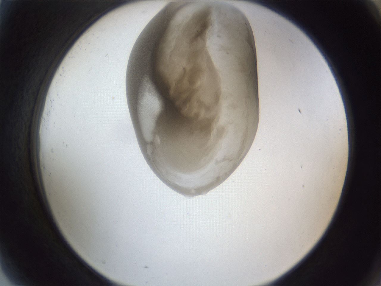 folderID161_plateID1161_batchID3209_wellNum81_profileID1_d2_r63360_ef.jpg