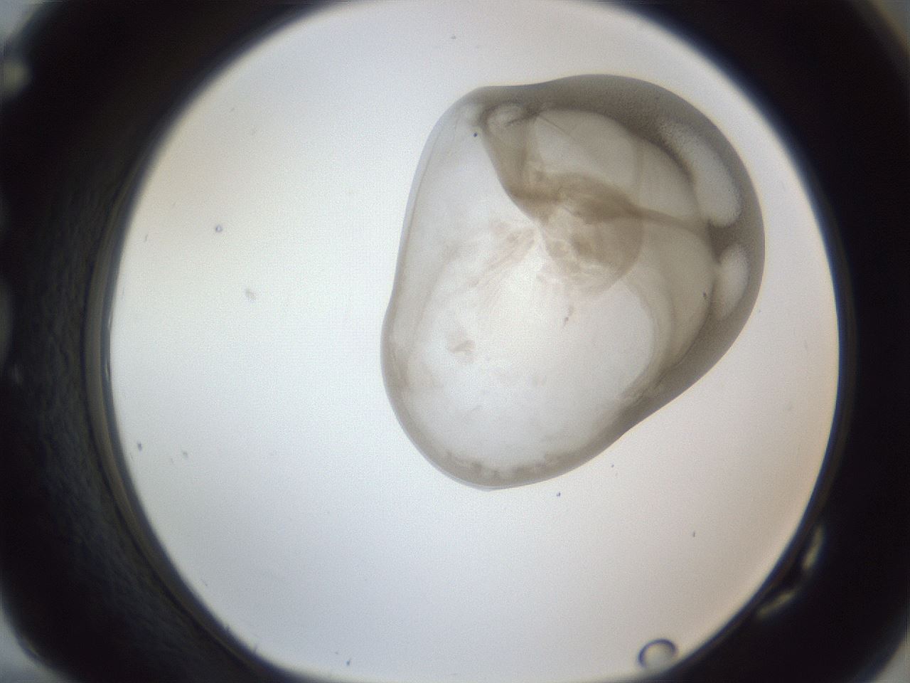 folderID161_plateID1161_batchID3209_wellNum82_profileID1_d1_r63361_ef.jpg