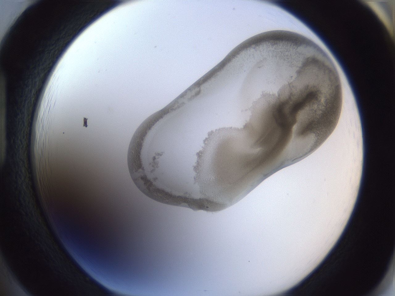 folderID161_plateID1161_batchID3209_wellNum85_profileID1_d1_r63367_ef.jpg