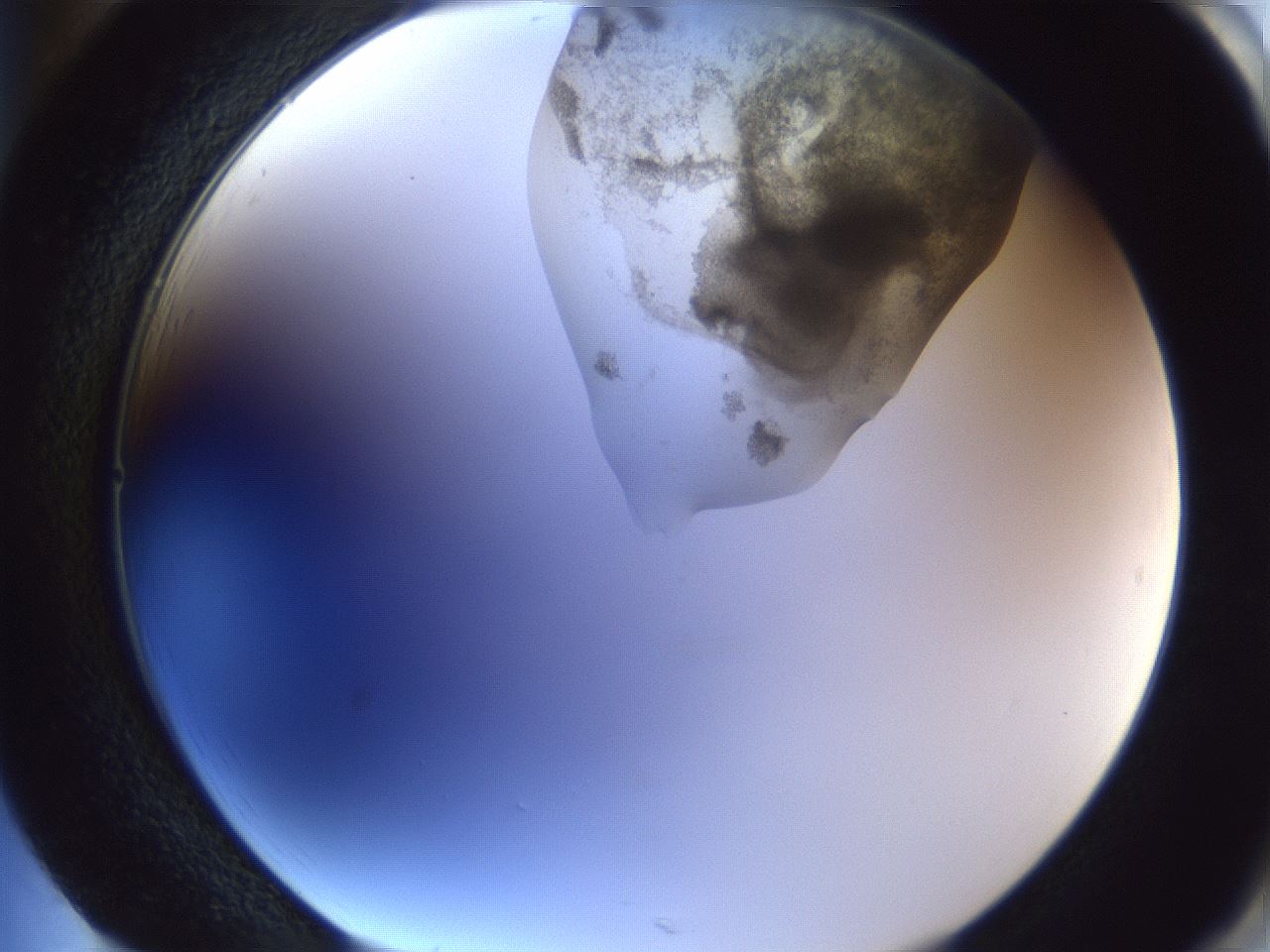 folderID161_plateID1161_batchID3209_wellNum85_profileID1_d2_r63368_ef.jpg