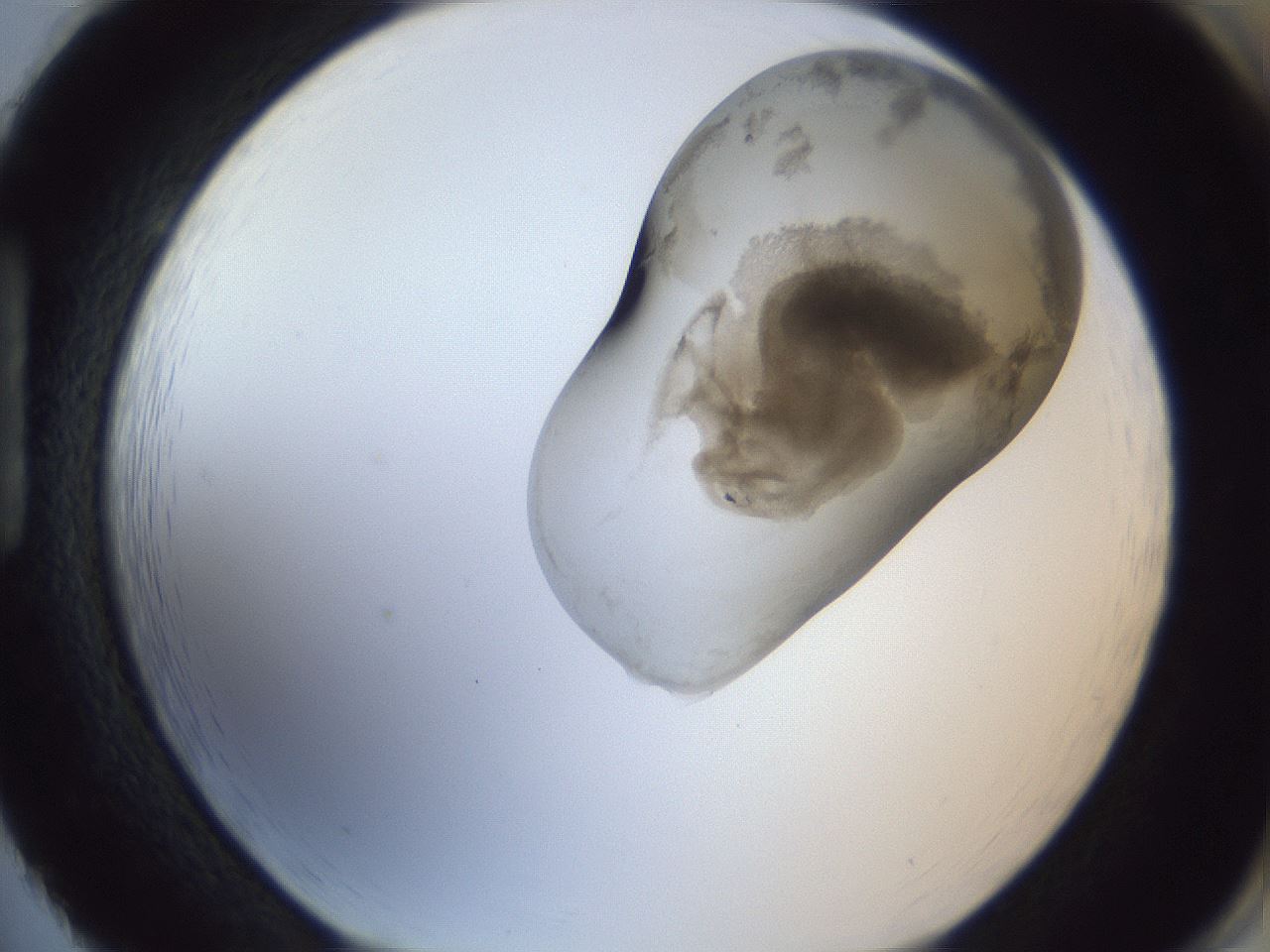 folderID161_plateID1161_batchID3209_wellNum86_profileID1_d1_r63369_ef.jpg