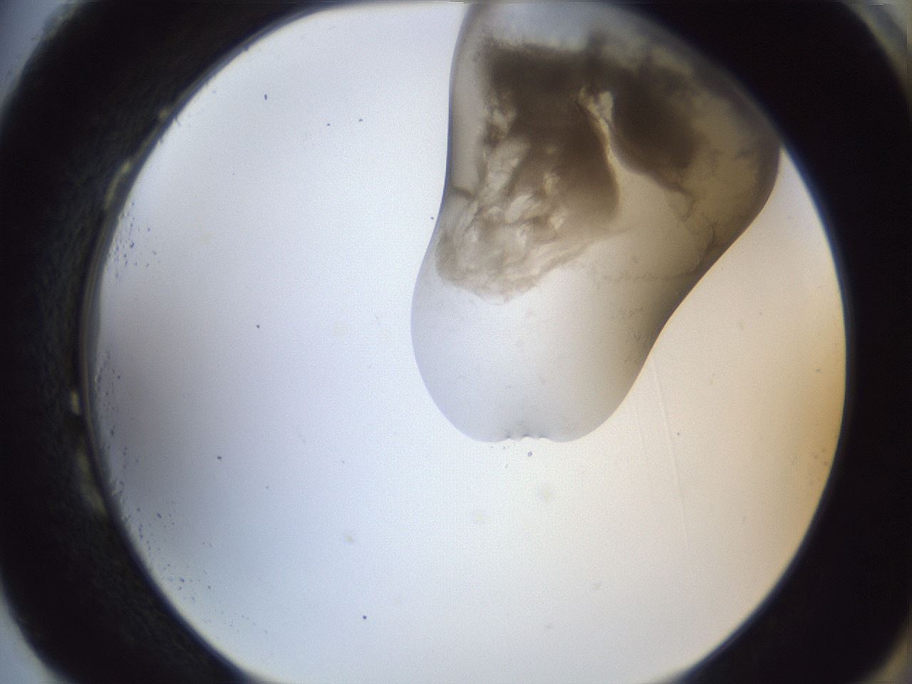 folderID161_plateID1161_batchID3209_wellNum87_profileID1_d2_r63372_ef.jpg