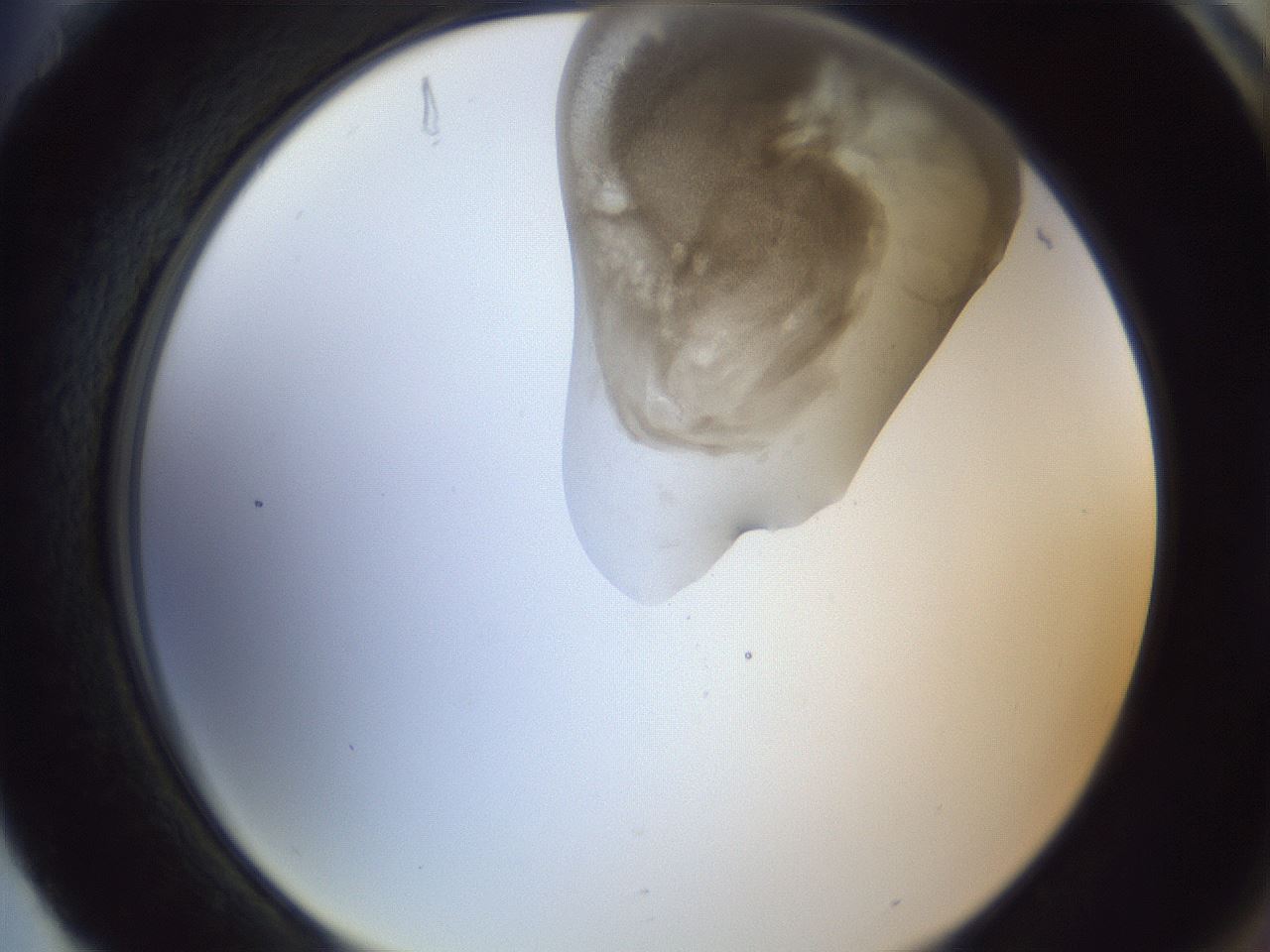 folderID161_plateID1161_batchID3209_wellNum88_profileID1_d2_r63374_ef.jpg