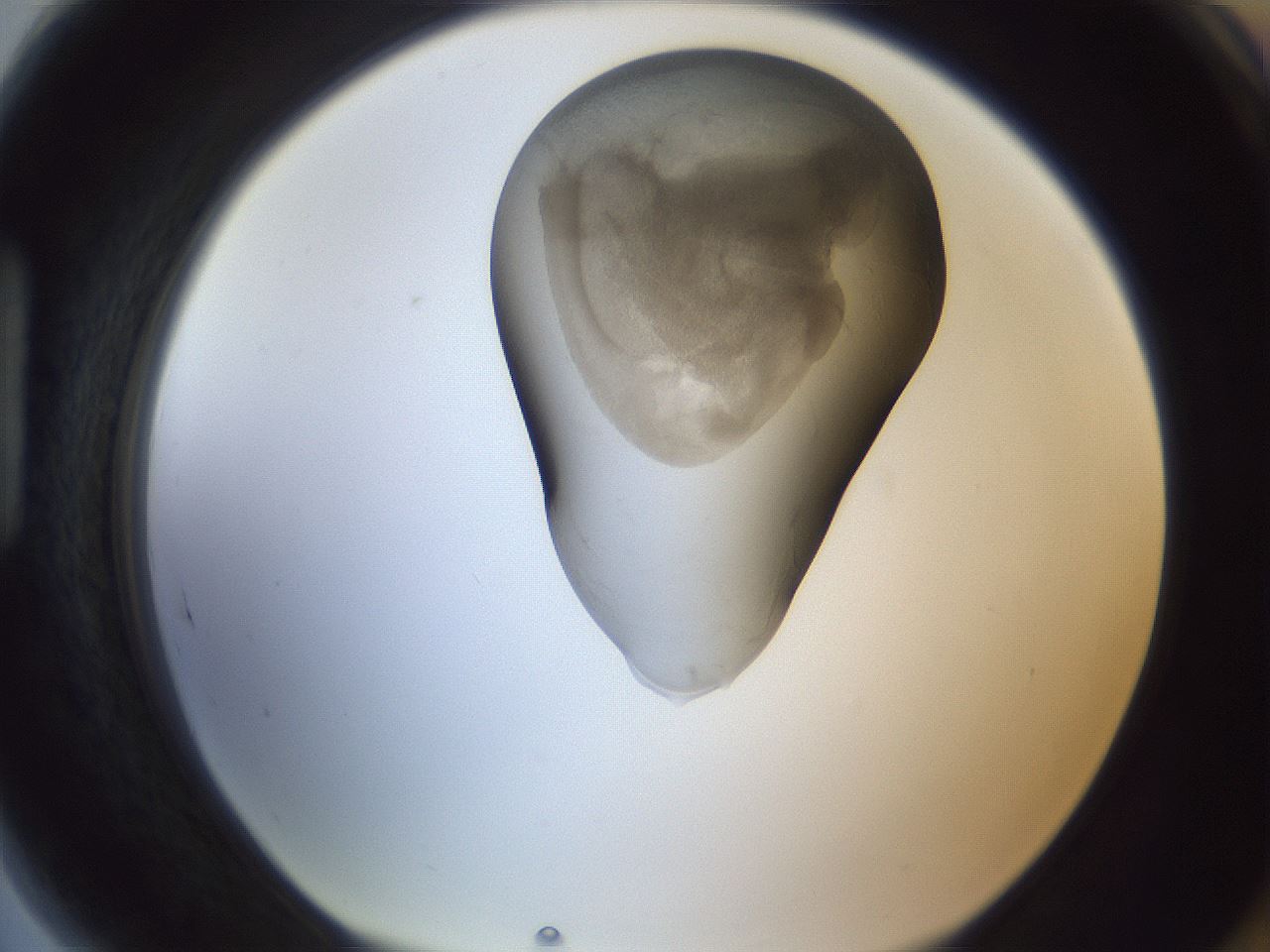 folderID161_plateID1161_batchID3209_wellNum89_profileID1_d1_r63375_ef.jpg