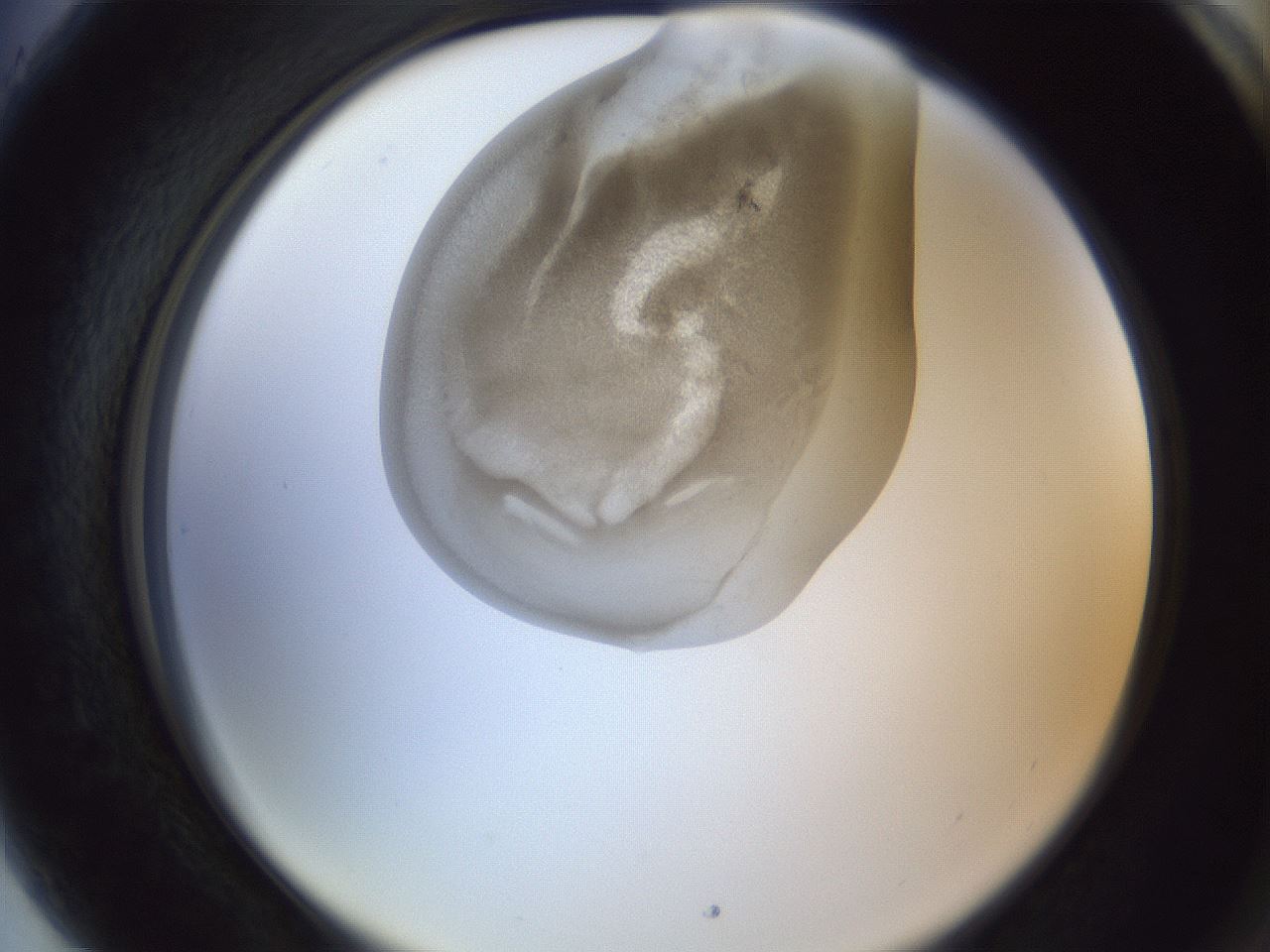 folderID161_plateID1161_batchID3209_wellNum89_profileID1_d2_r63376_ef.jpg