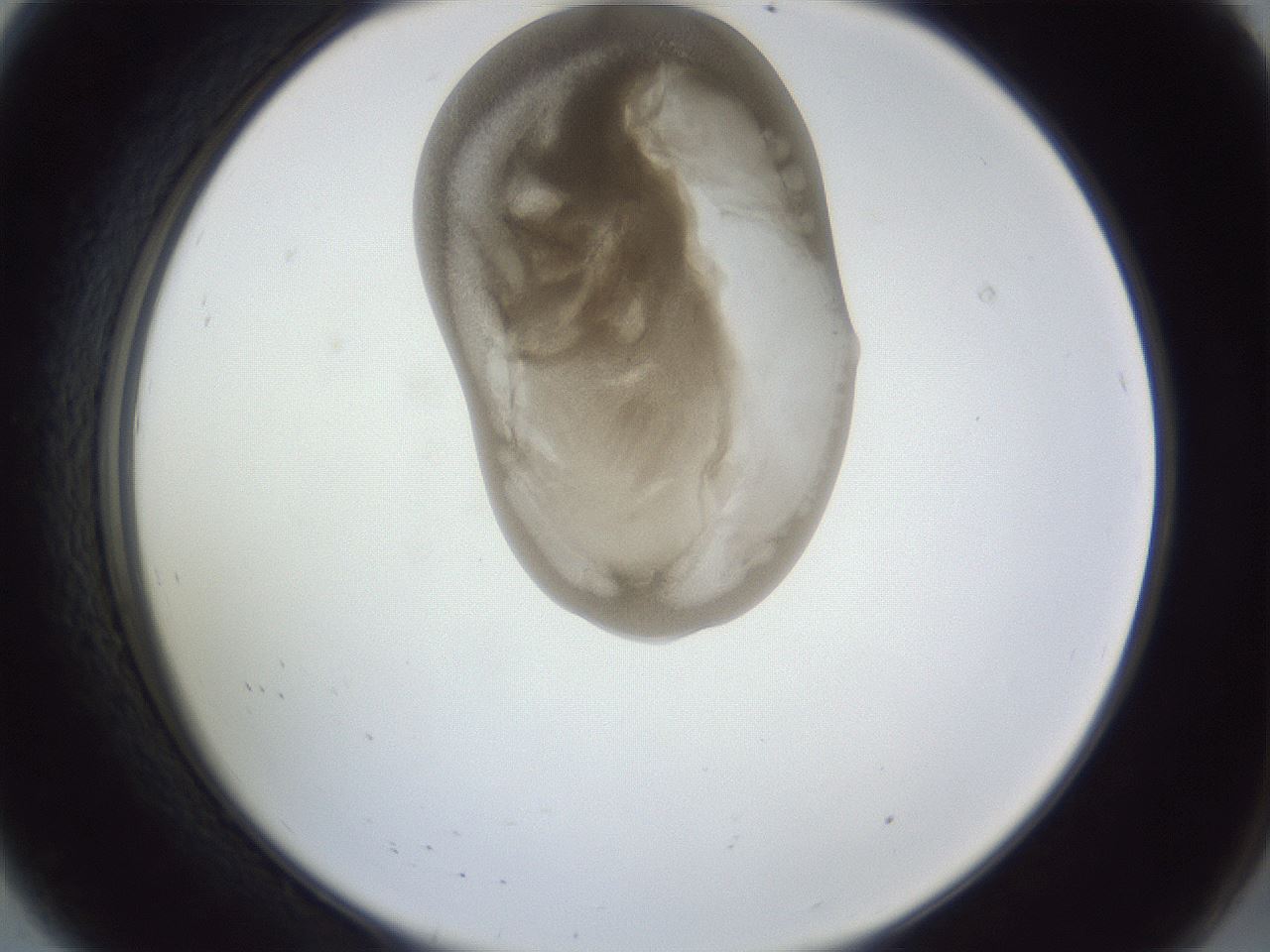 folderID161_plateID1161_batchID3209_wellNum8_profileID1_d2_r63214_ef.jpg