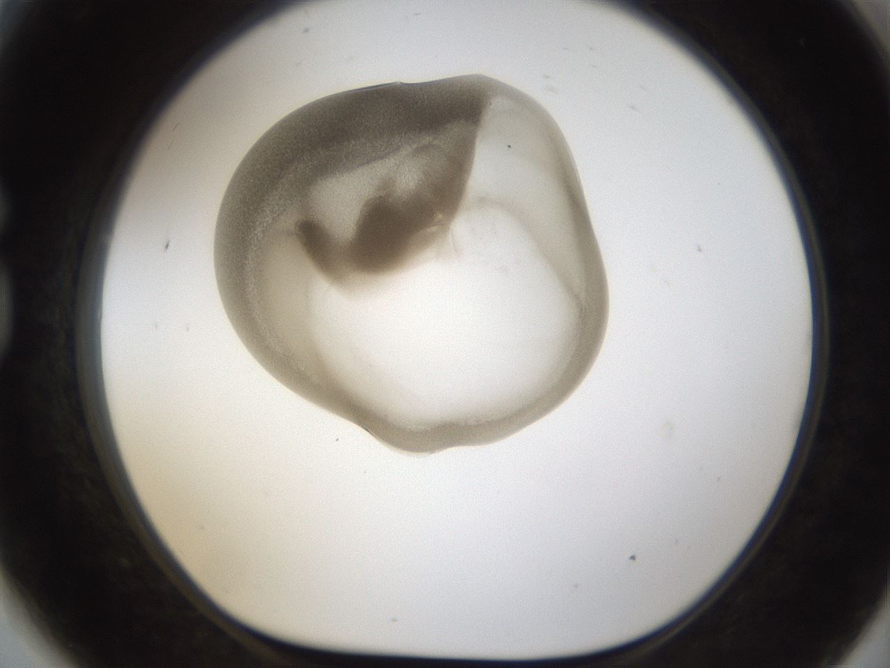 folderID160_plateID1160_batchID3204_wellNum81_profileID1_d1_r62399_ef.jpg