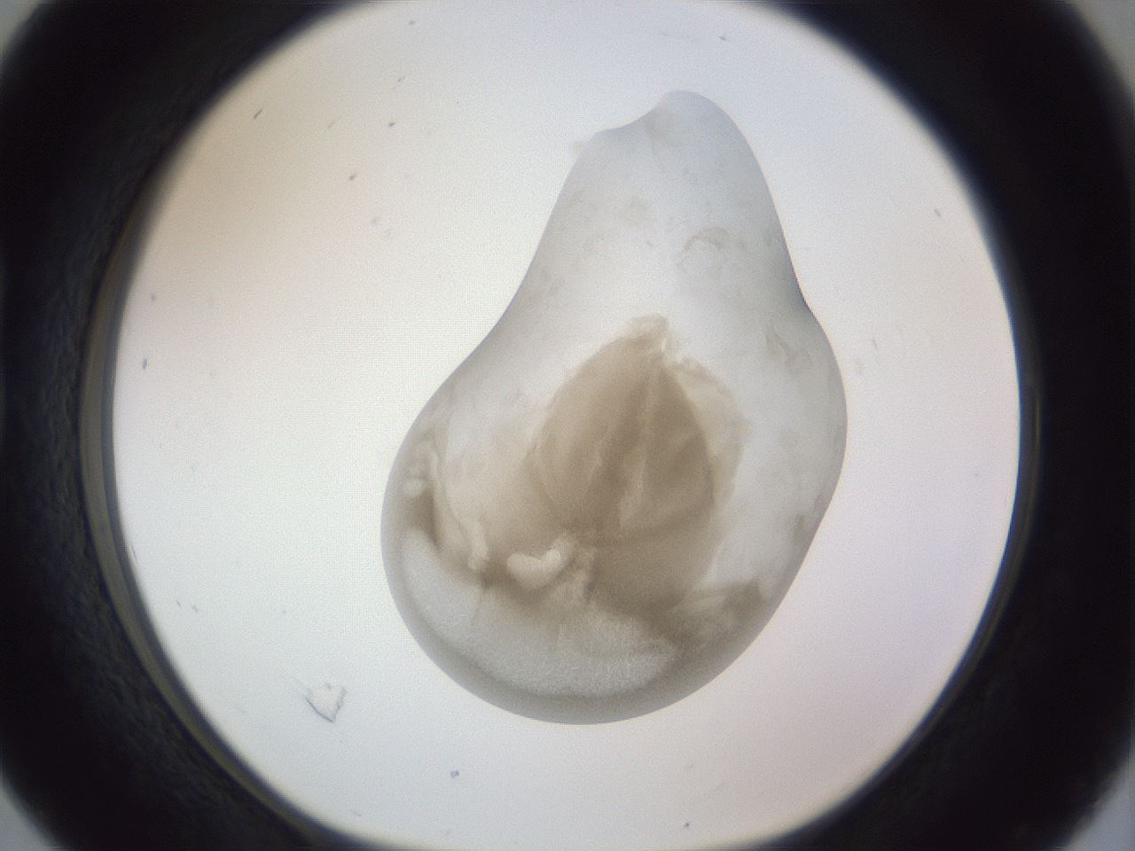 folderID161_plateID1161_batchID3209_wellNum16_profileID1_d1_r63229_ef.jpg