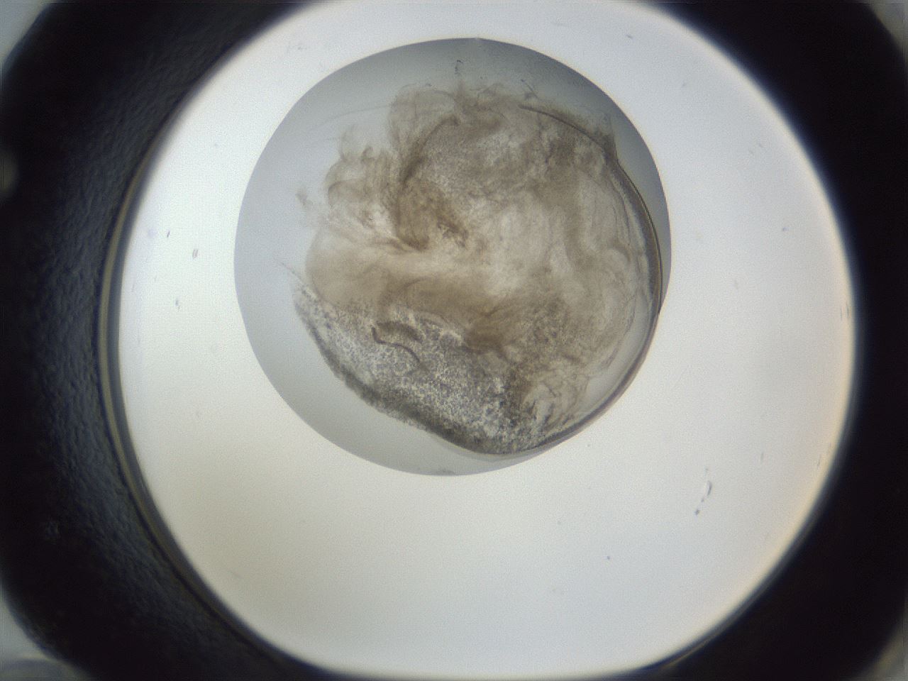 folderID161_plateID1161_batchID3209_wellNum72_profileID1_d1_r63341_ef.jpg