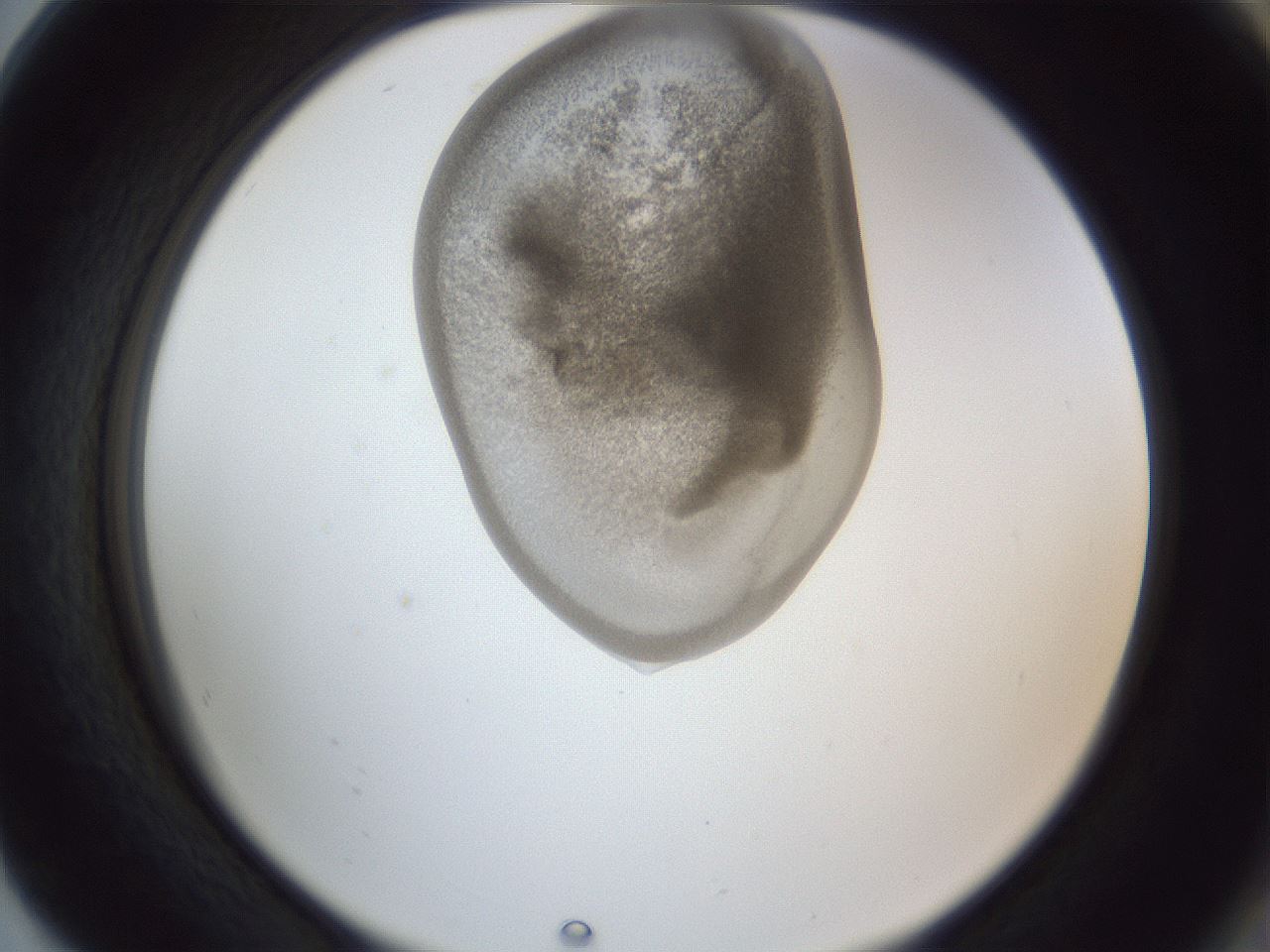 folderID161_plateID1161_batchID3209_wellNum80_profileID1_d2_r63358_ef.jpg