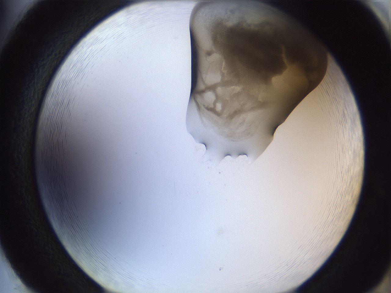 folderID161_plateID1161_batchID3209_wellNum86_profileID1_d2_r63370_ef.jpg
