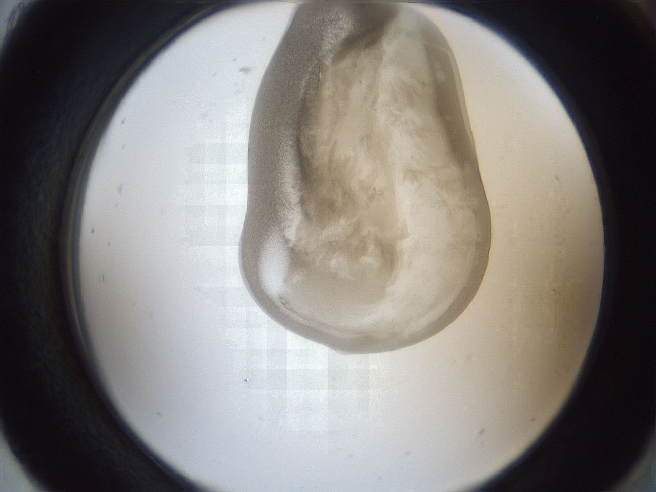 folderID161_plateID1161_batchID3209_wellNum93_profileID1_d2_r63384_ef.jpg
