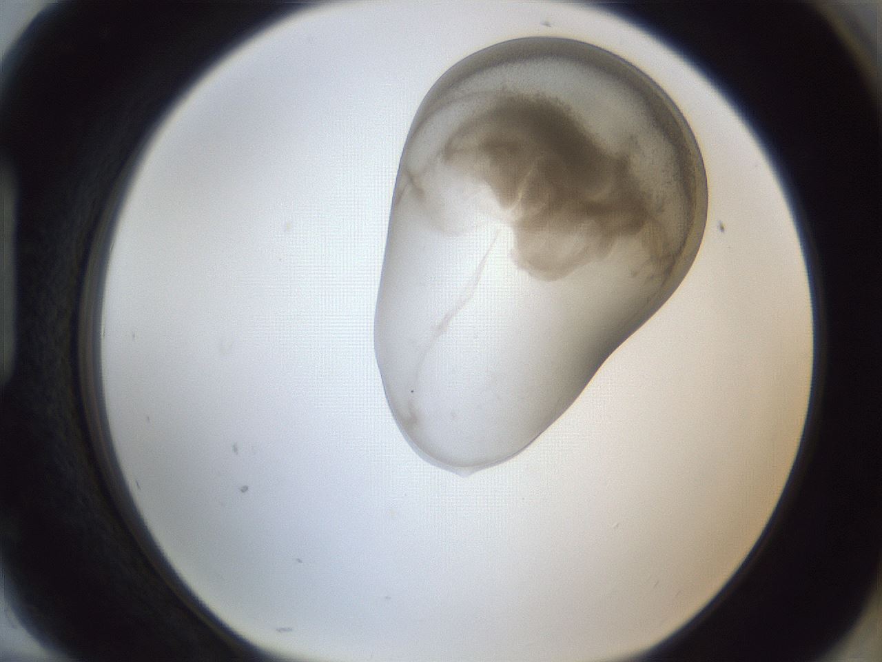 folderID161_plateID1161_batchID3209_wellNum94_profileID1_d1_r63385_ef.jpg