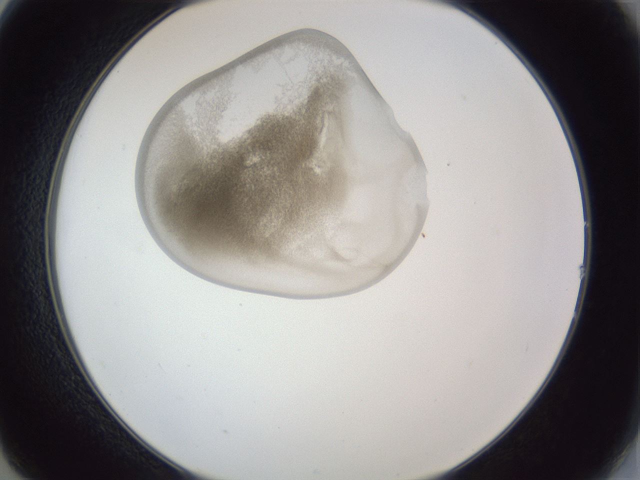 folderID162_plateID1162_batchID3203_wellNum14_profileID1_d2_r62074_ef.jpg