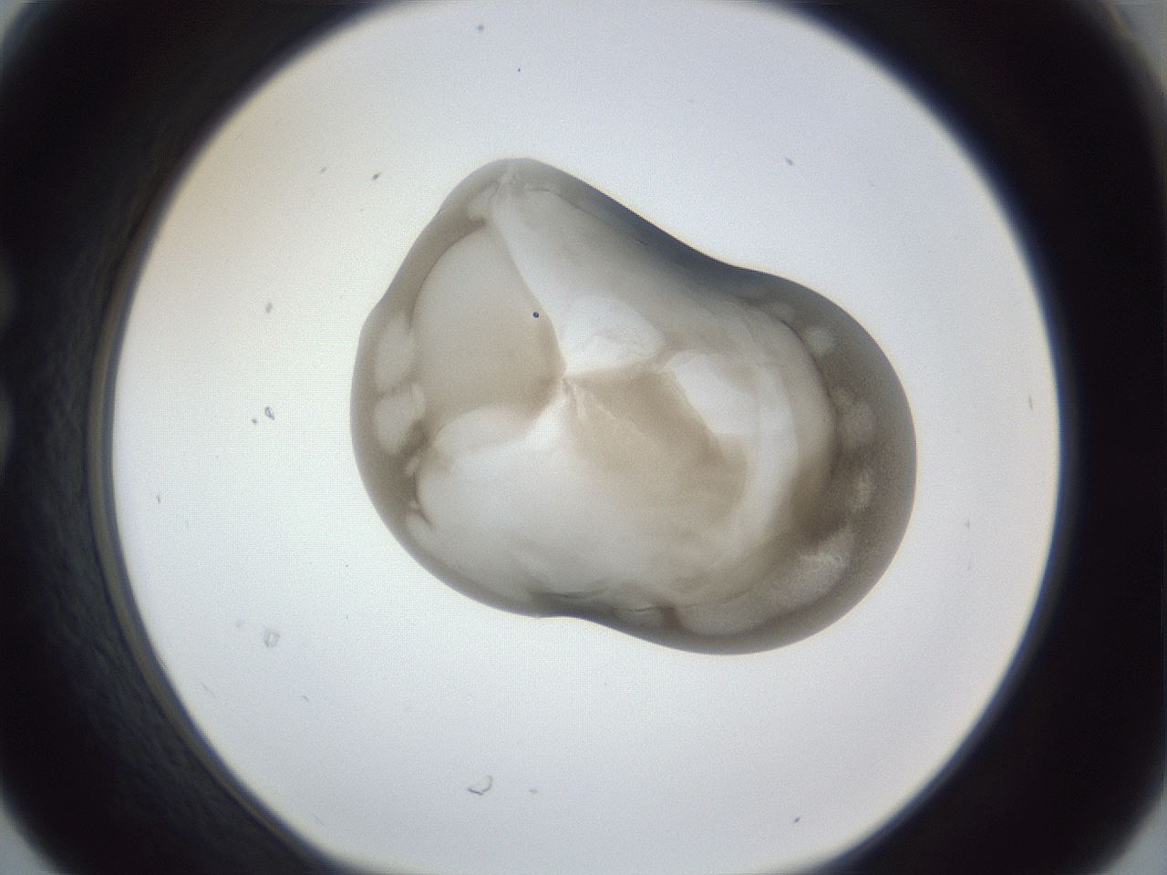 folderID162_plateID1162_batchID3203_wellNum30_profileID1_d1_r62105_ef.jpg