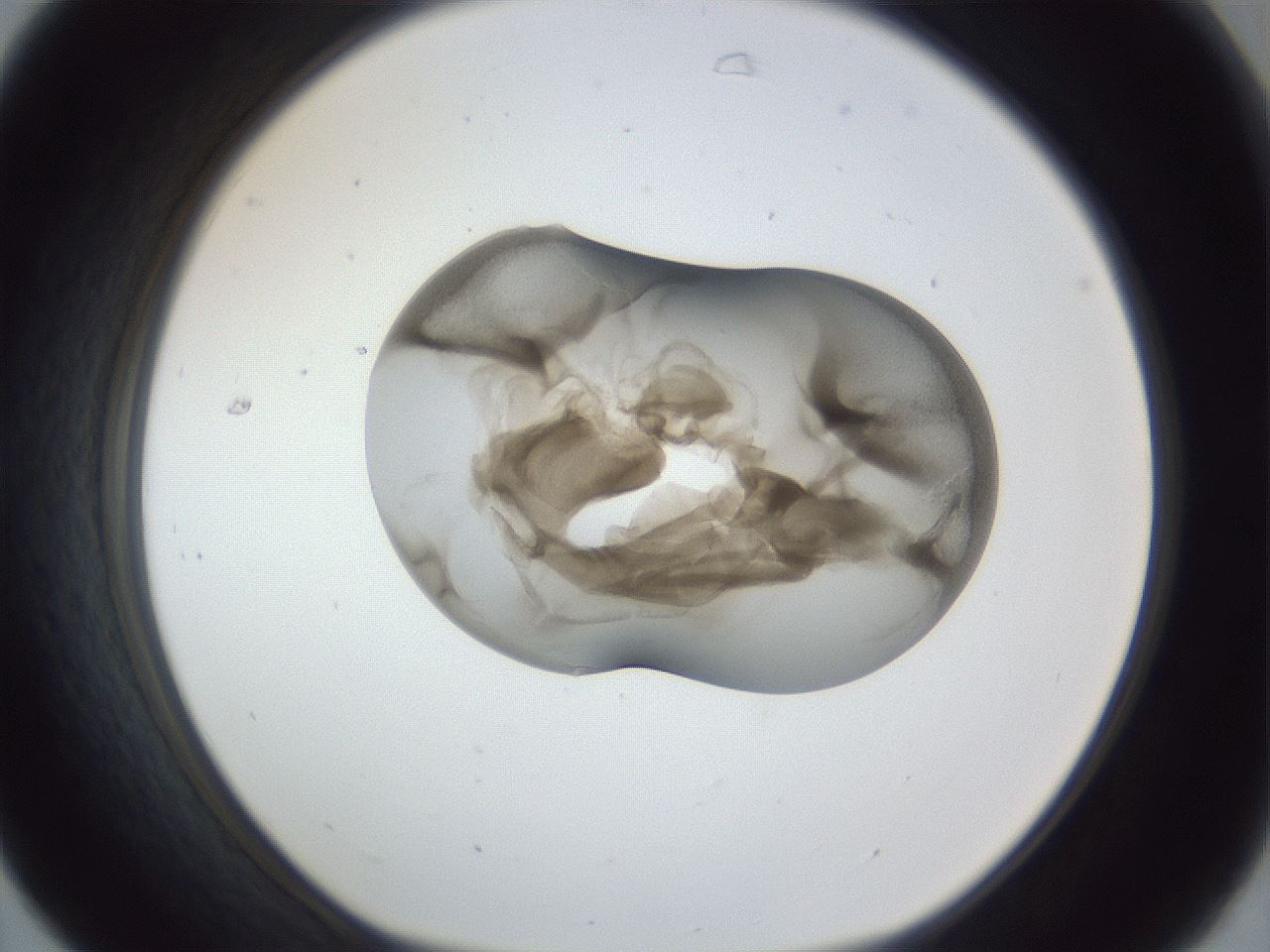 folderID162_plateID1162_batchID3203_wellNum31_profileID1_d1_r62107_ef.jpg