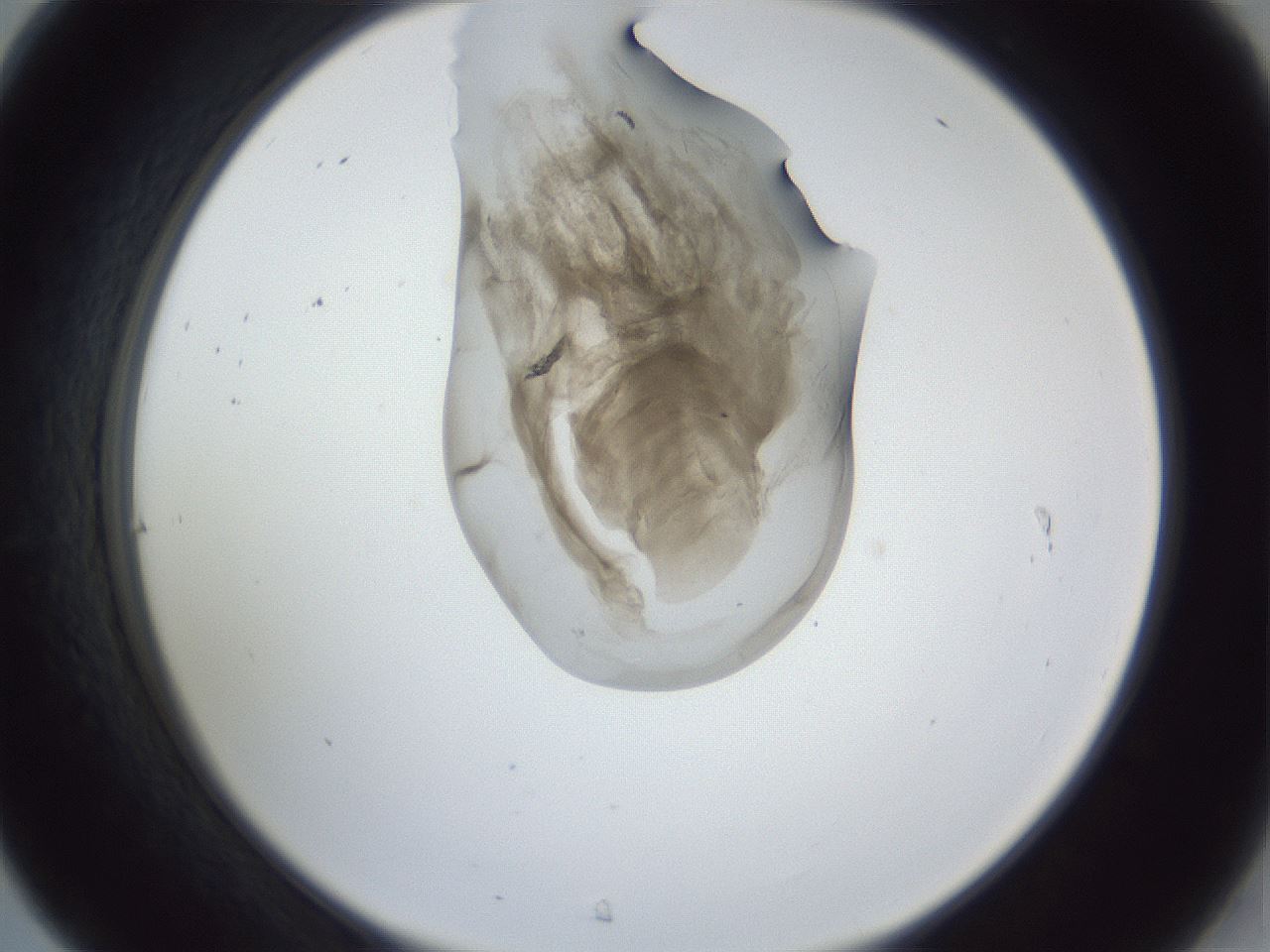folderID162_plateID1162_batchID3203_wellNum31_profileID1_d2_r62108_ef.jpg