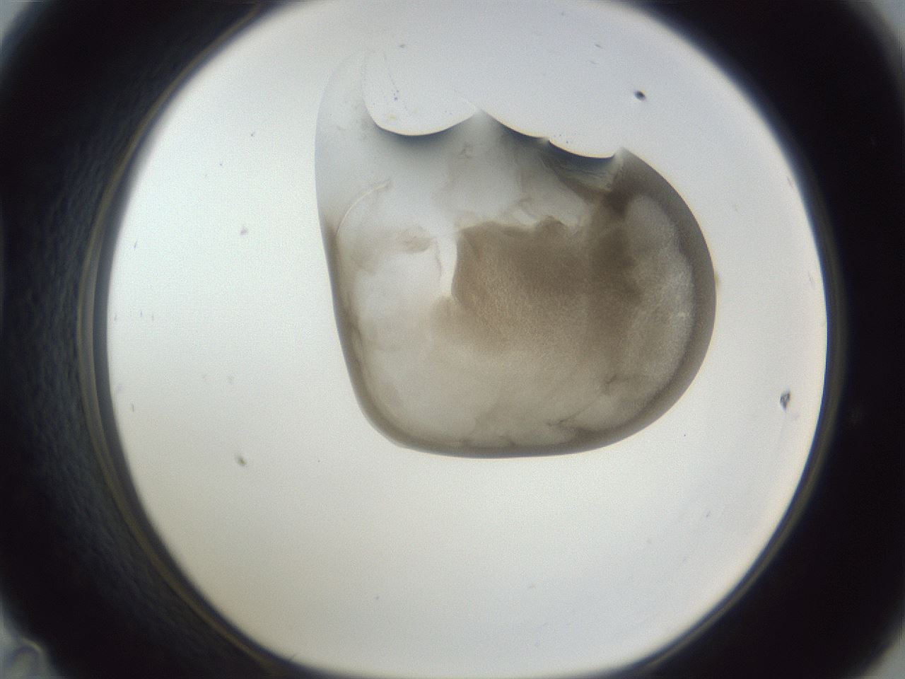 folderID162_plateID1162_batchID3203_wellNum47_profileID1_d1_r62139_ef.jpg