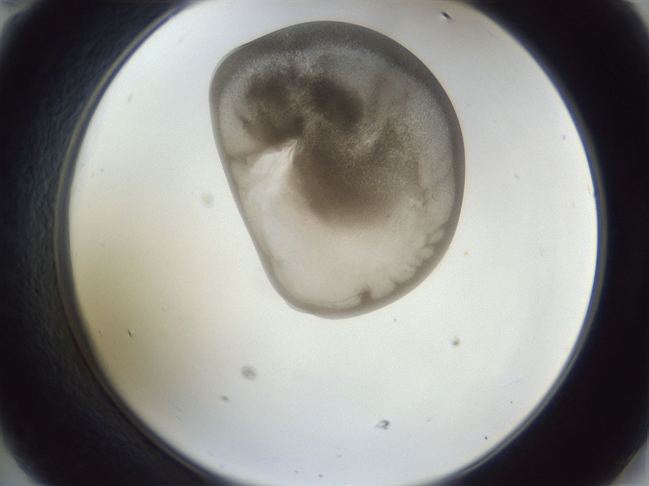 folderID162_plateID1162_batchID3203_wellNum47_profileID1_d2_r62140_ef.jpg