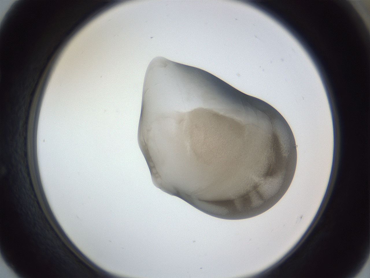 folderID162_plateID1162_batchID3203_wellNum52_profileID1_d1_r62149_ef.jpg