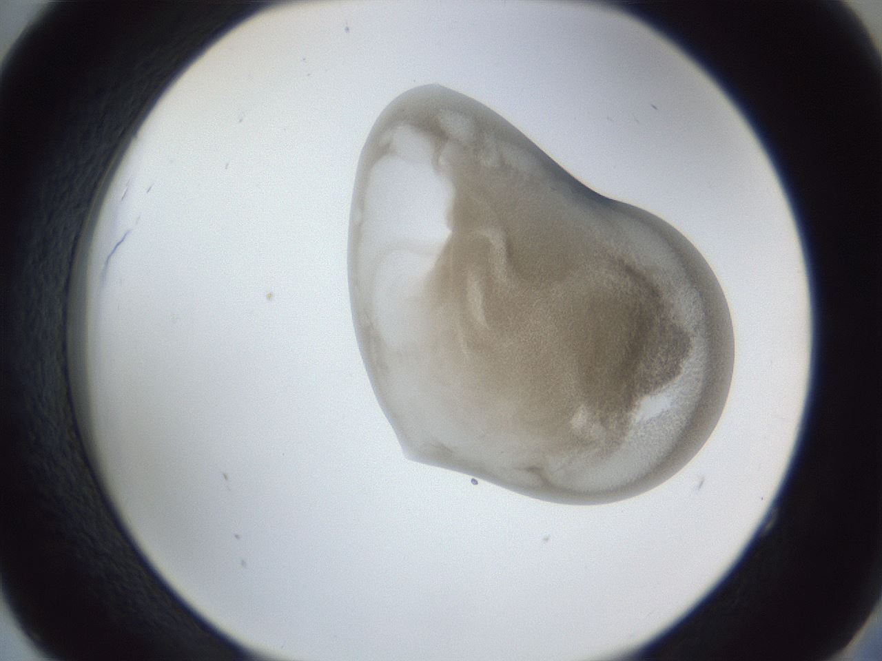 folderID162_plateID1162_batchID3203_wellNum52_profileID1_d2_r62150_ef.jpg