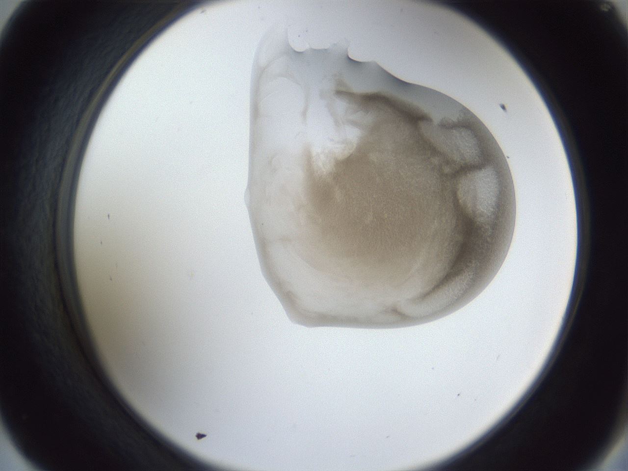 folderID162_plateID1162_batchID3203_wellNum57_profileID1_d2_r62160_ef.jpg