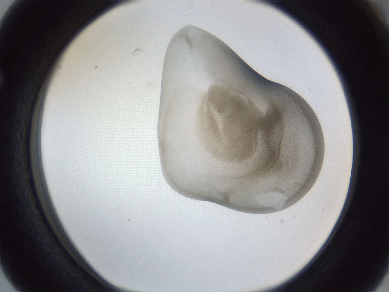 folderID162_plateID1162_batchID3203_wellNum63_profileID1_d1_r62171_ef.jpg