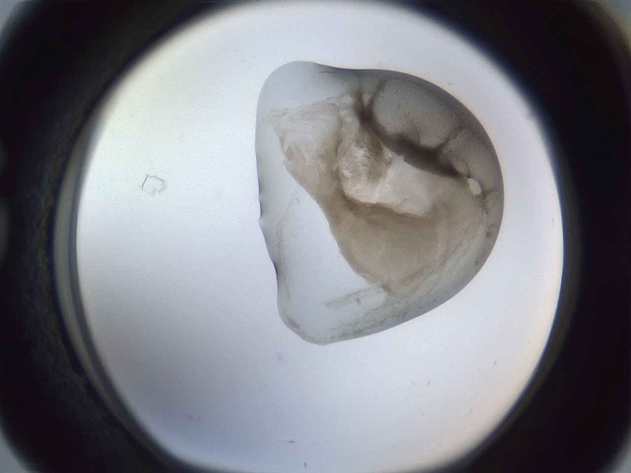 folderID162_plateID1162_batchID3203_wellNum76_profileID1_d1_r62197_ef.jpg