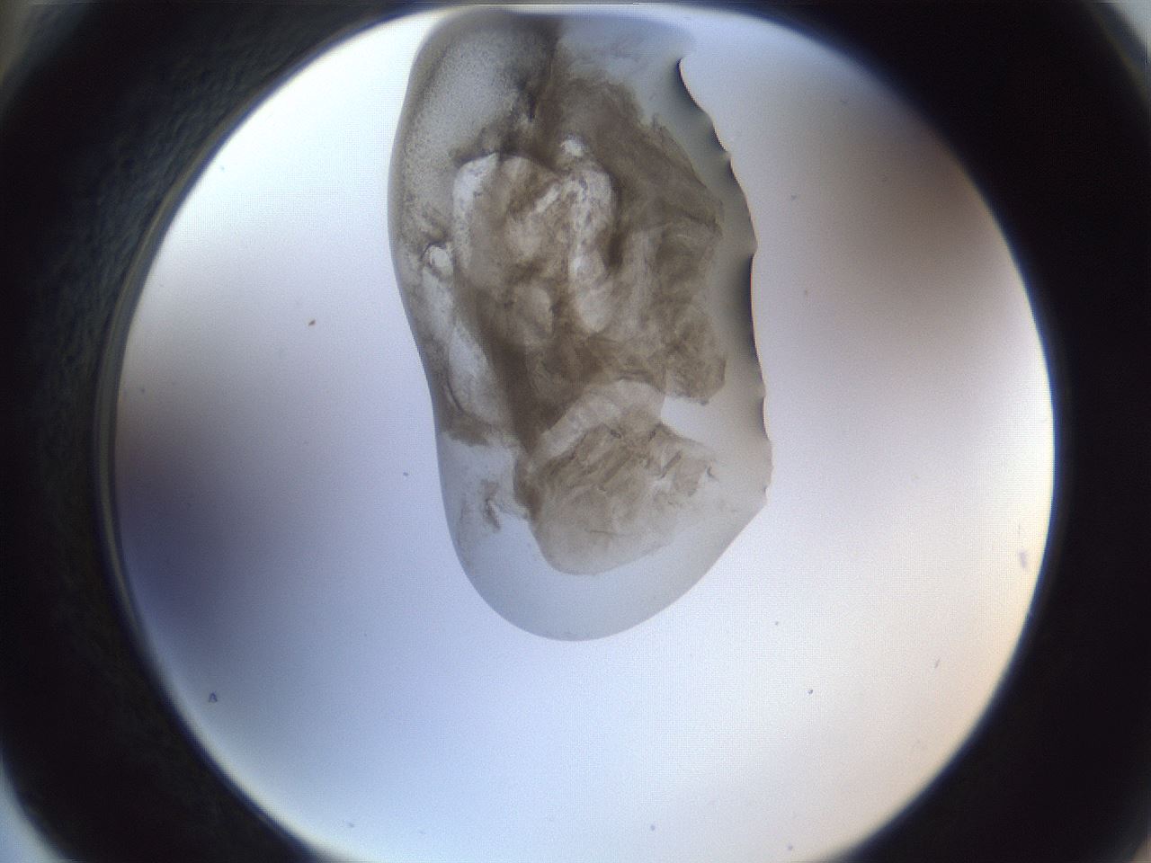 folderID162_plateID1162_batchID3203_wellNum76_profileID1_d2_r62198_ef.jpg