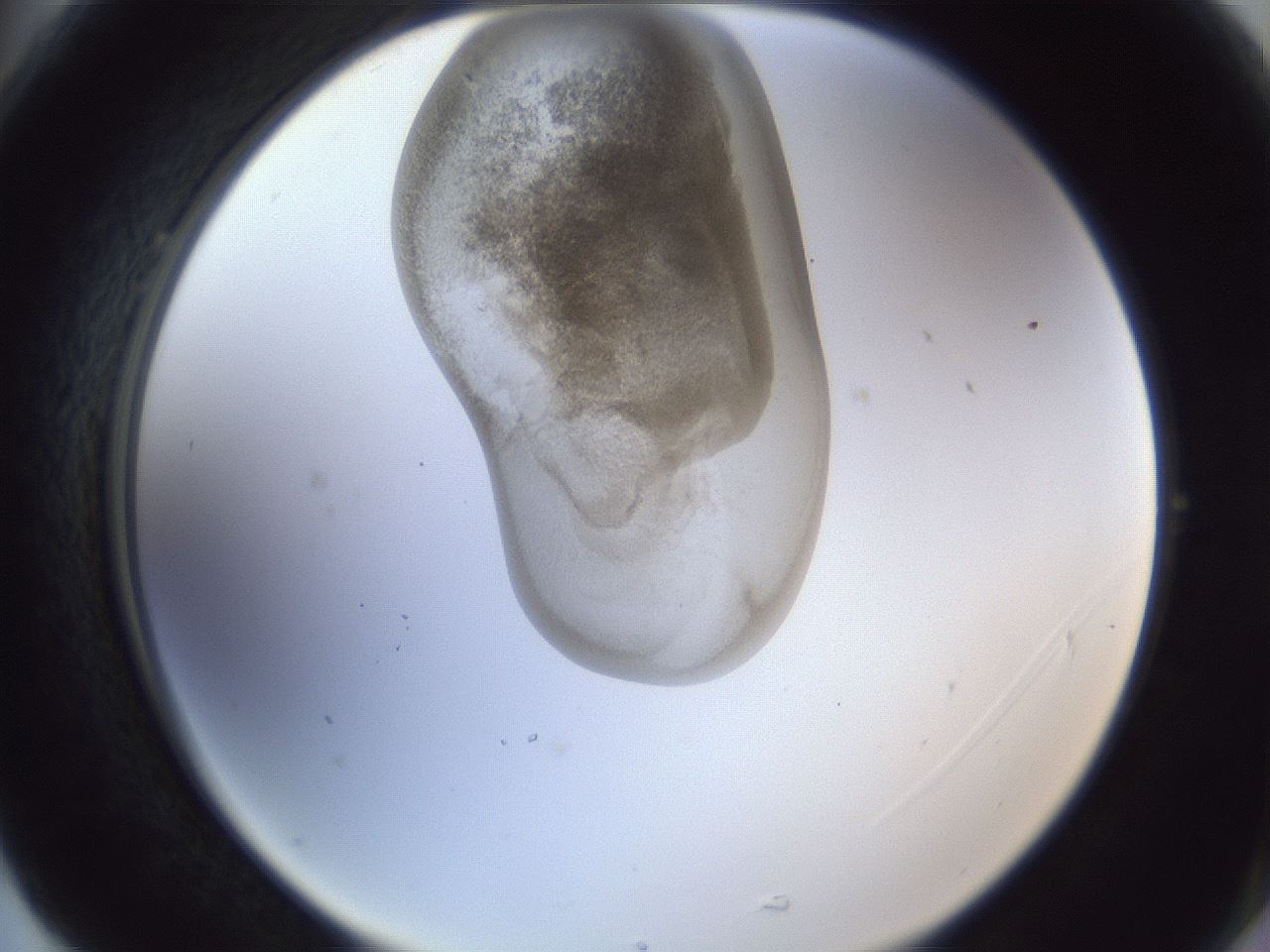 folderID162_plateID1162_batchID3203_wellNum77_profileID1_d2_r62200_ef.jpg