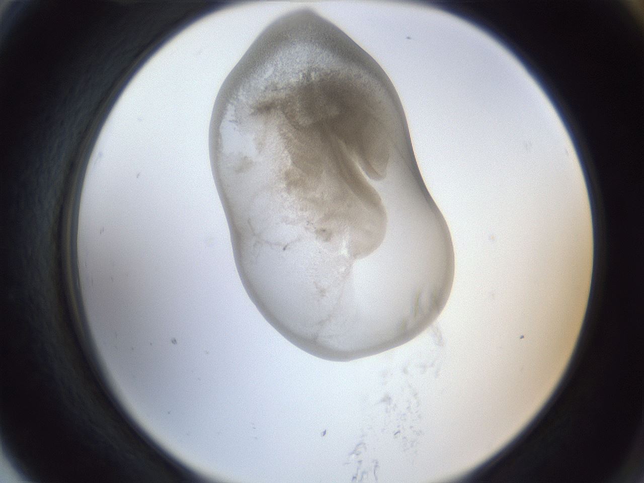folderID162_plateID1162_batchID3203_wellNum79_profileID1_d2_r62204_ef.jpg
