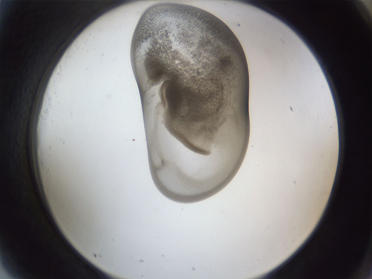 folderID162_plateID1162_batchID3203_wellNum81_profileID1_d2_r62208_ef.jpg