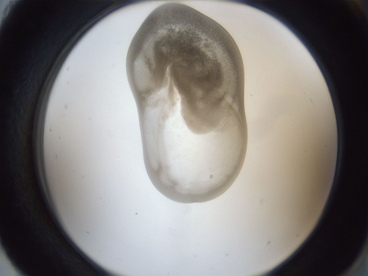 folderID162_plateID1162_batchID3203_wellNum93_profileID1_d2_r62232_ef.jpg