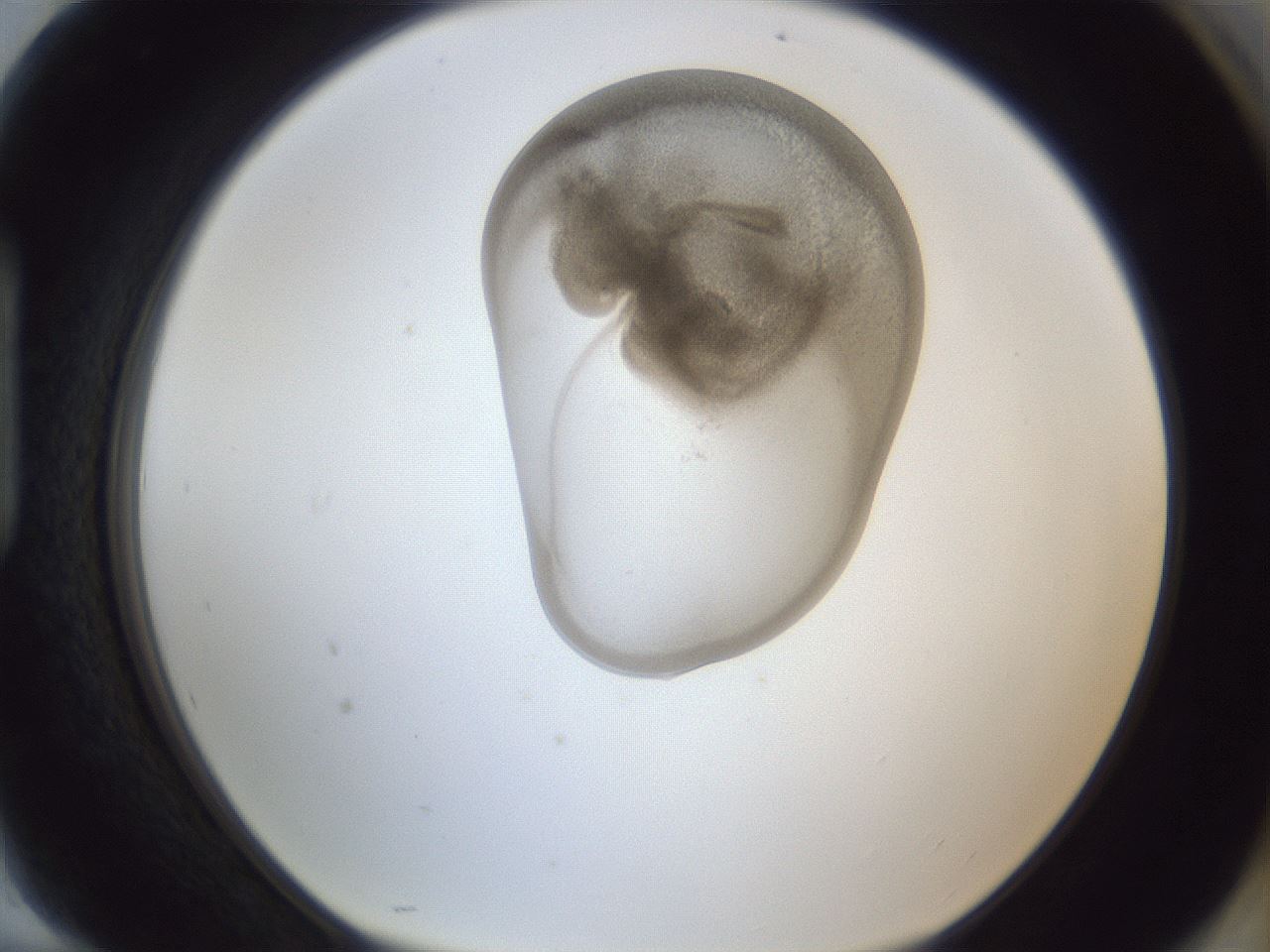 folderID162_plateID1162_batchID3203_wellNum94_profileID1_d1_r62233_ef.jpg