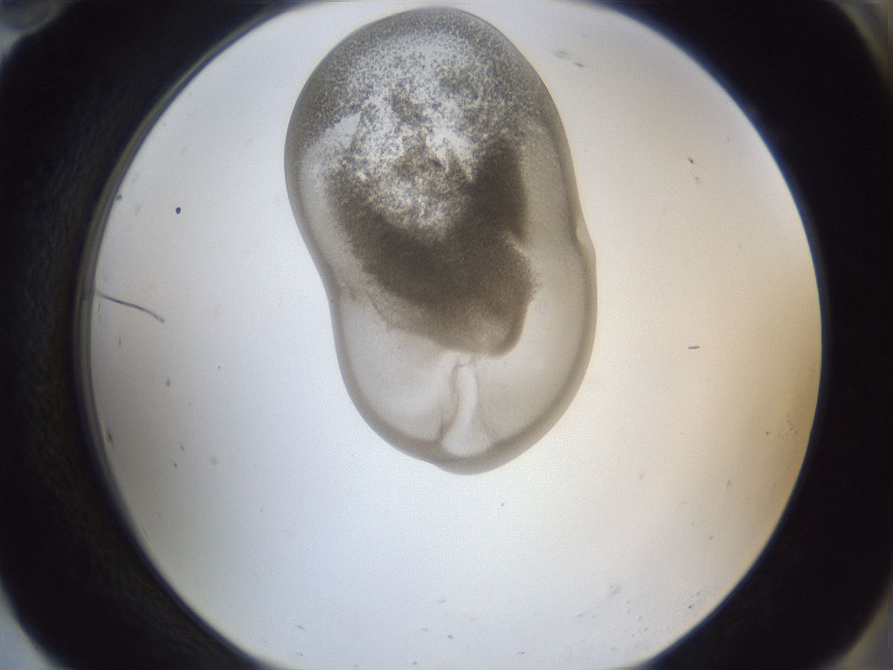 folderID162_plateID1162_batchID3203_wellNum94_profileID1_d2_r62234_ef.jpg