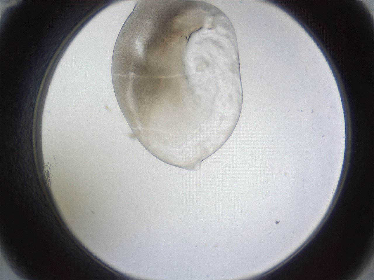 folderID163_plateID1163_batchID3206_wellNum11_profileID1_d2_r62644_ef.jpg