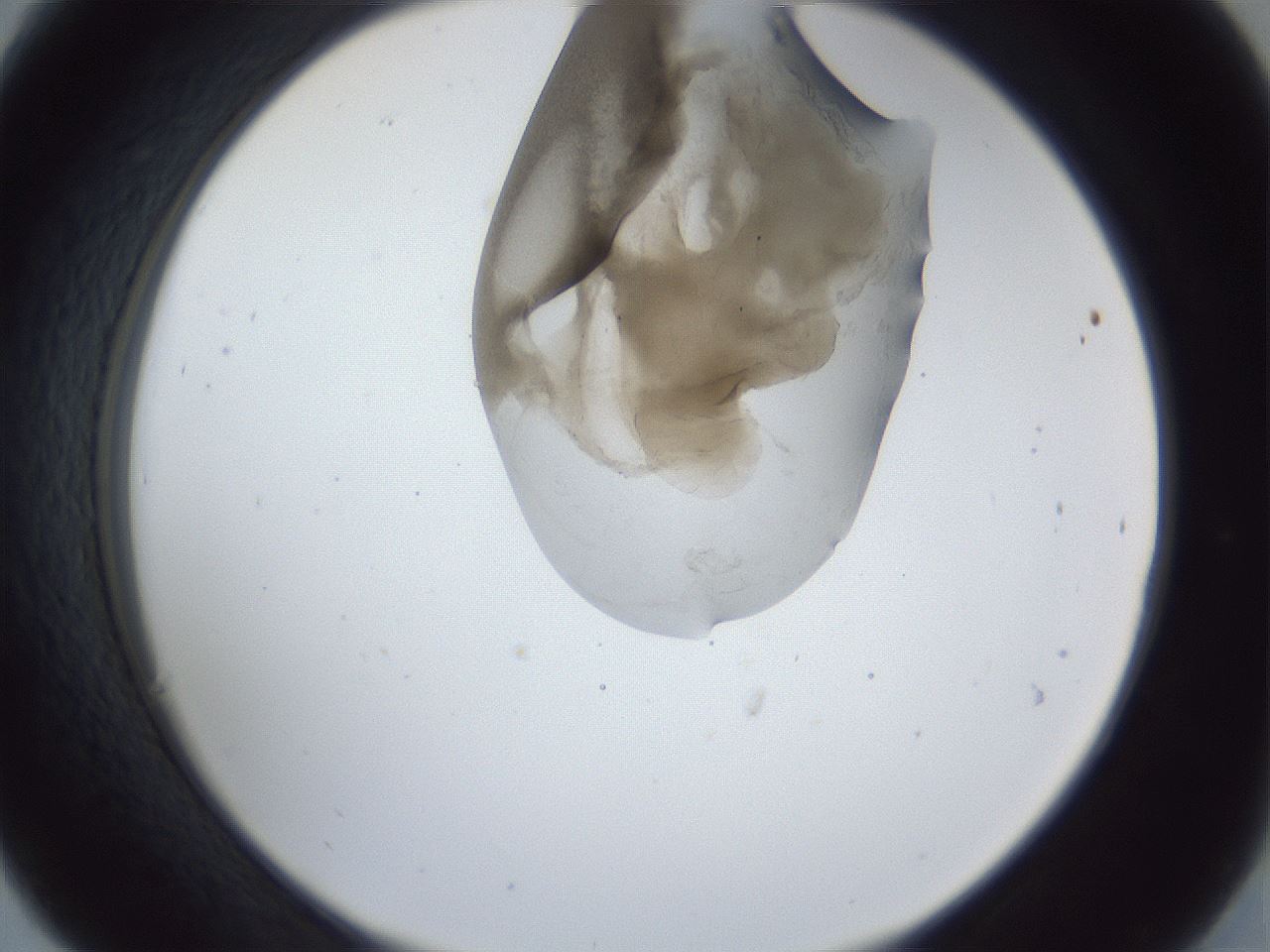folderID163_plateID1163_batchID3206_wellNum30_profileID1_d2_r62682_ef.jpg
