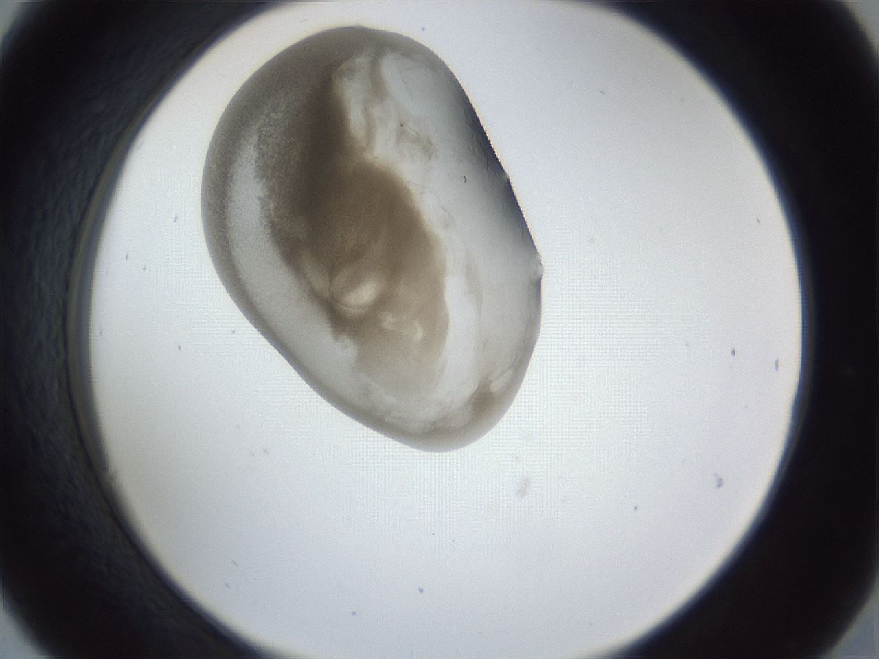 folderID162_plateID1162_batchID3203_wellNum30_profileID1_d2_r62106_ef.jpg
