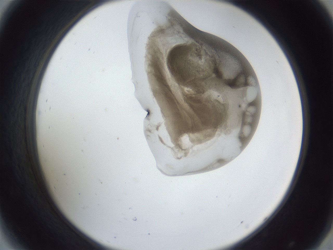 folderID162_plateID1162_batchID3203_wellNum44_profileID1_d2_r62134_ef.jpg