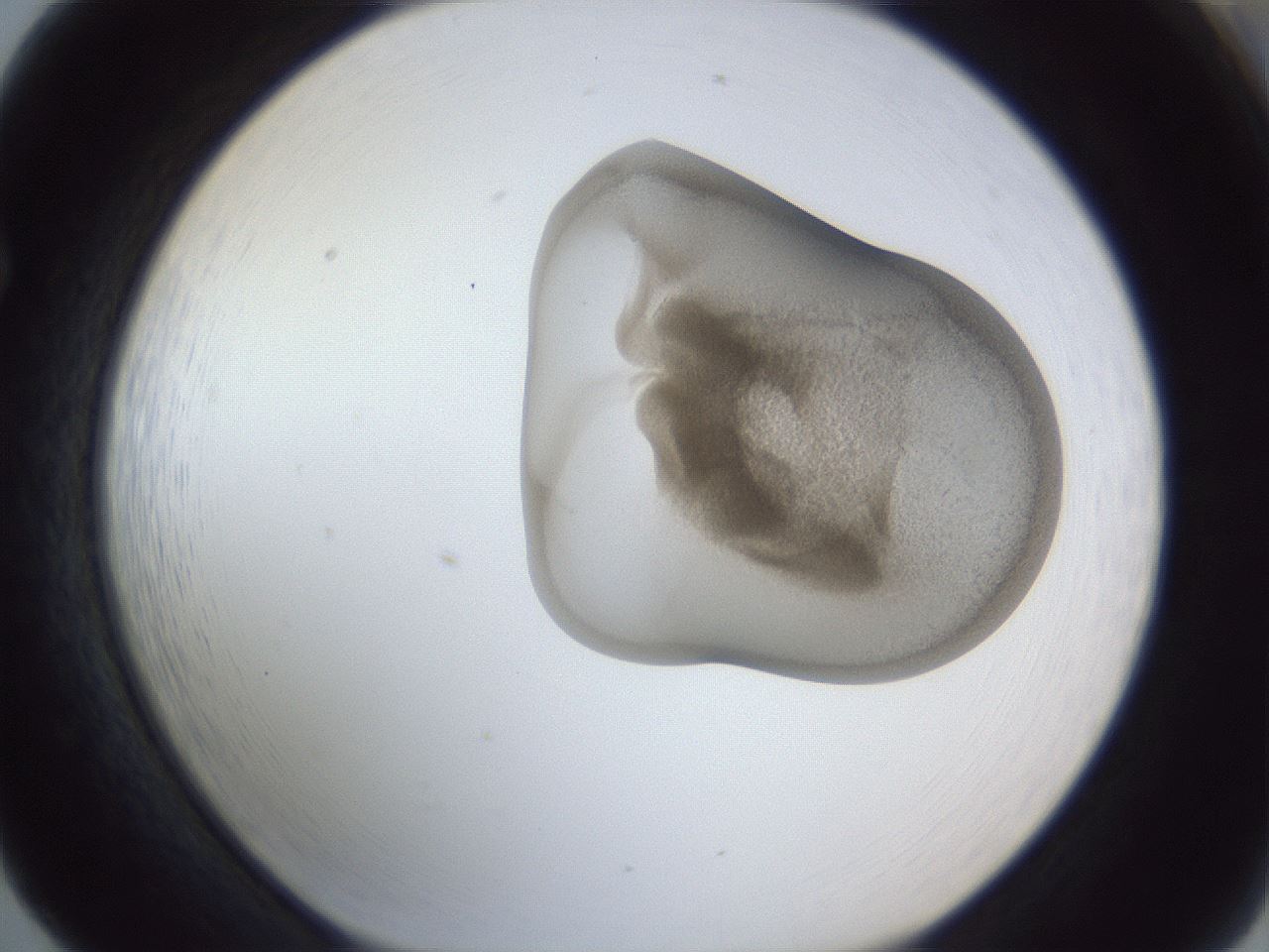 folderID162_plateID1162_batchID3203_wellNum65_profileID1_d1_r62175_ef.jpg