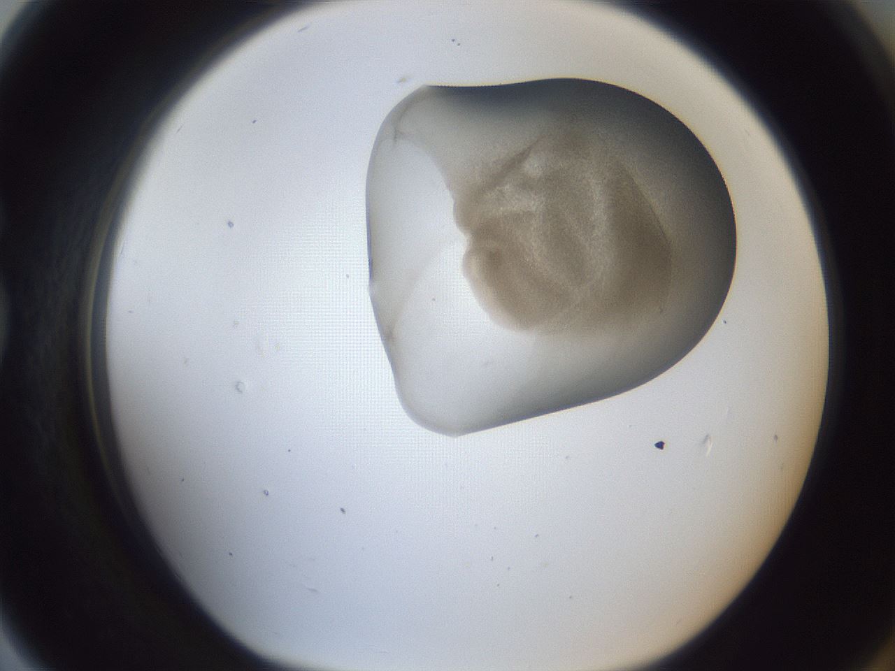 folderID162_plateID1162_batchID3203_wellNum79_profileID1_d1_r62203_ef.jpg