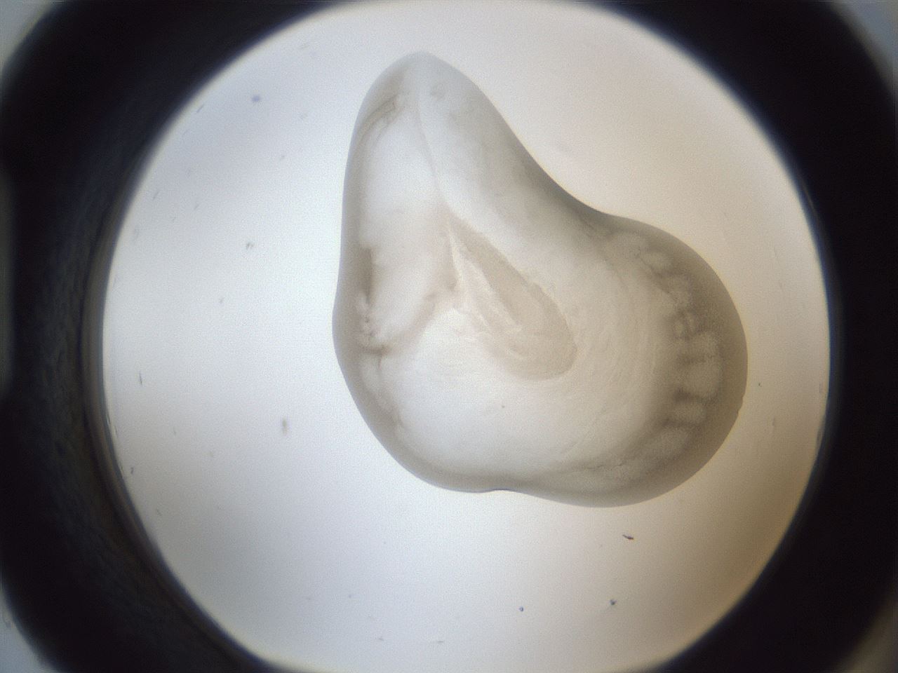 folderID162_plateID1162_batchID3203_wellNum93_profileID1_d1_r62231_ef.jpg