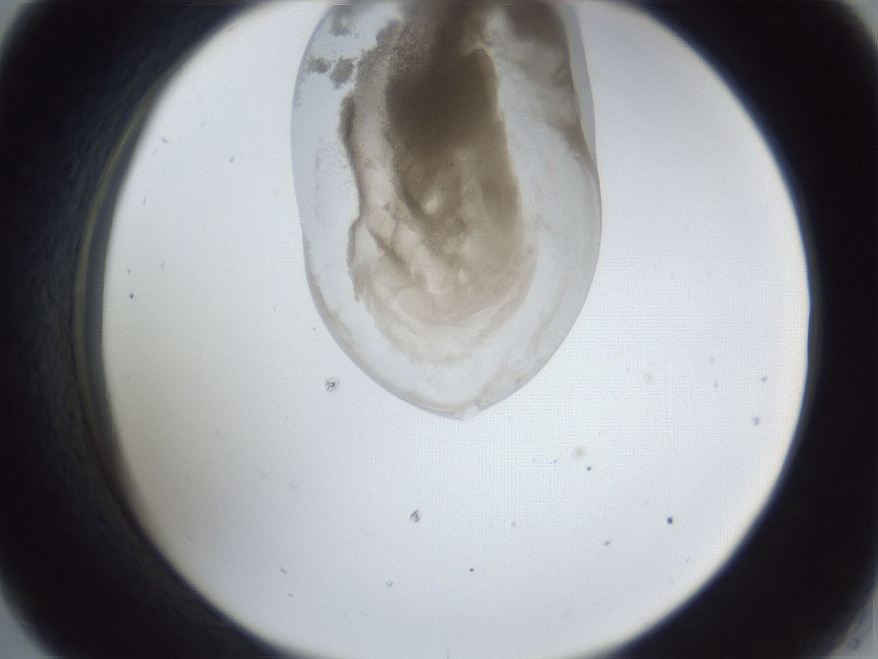 folderID163_plateID1163_batchID3206_wellNum33_profileID1_d2_r62688_ef.jpg