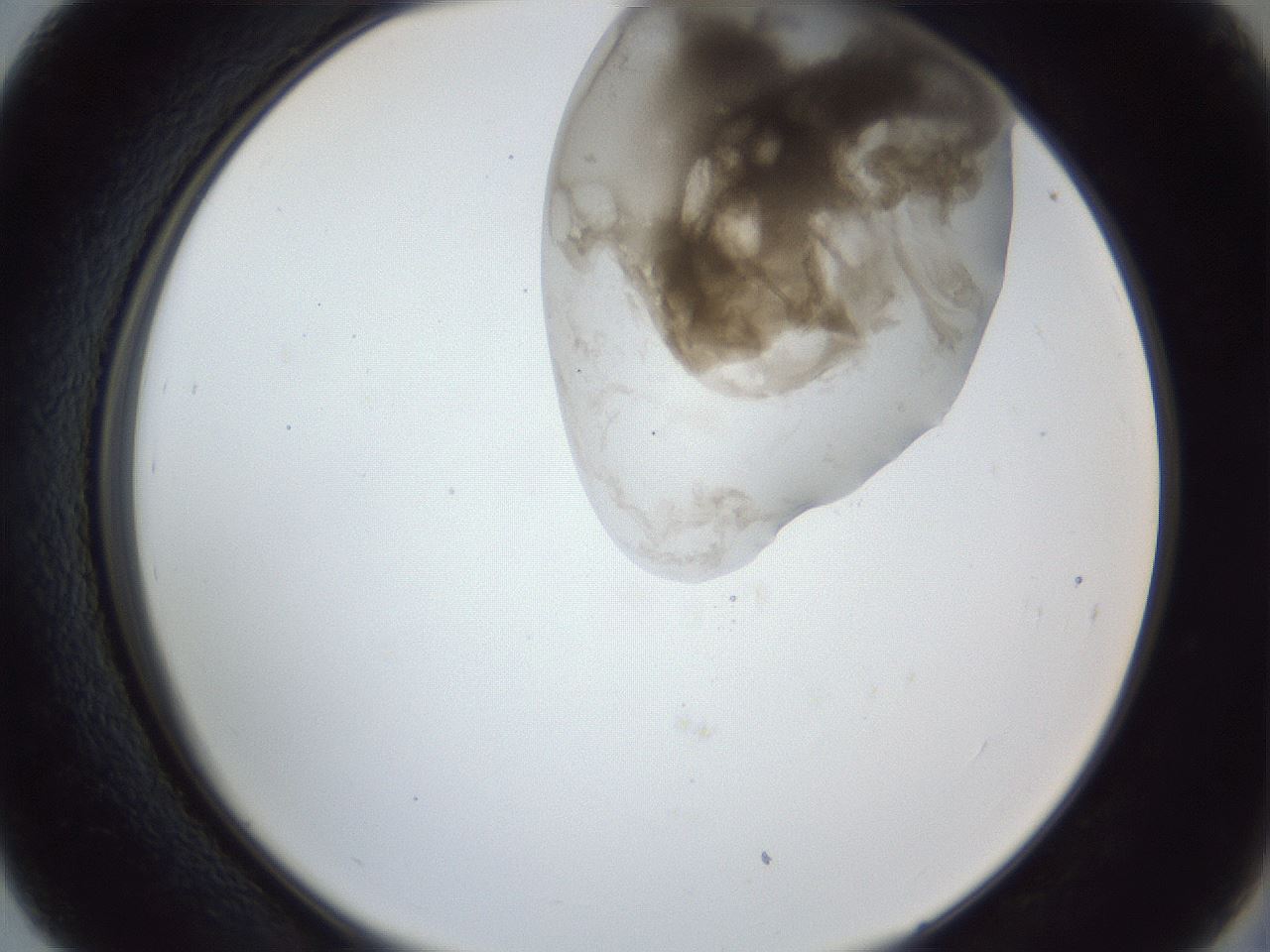 folderID163_plateID1163_batchID3206_wellNum39_profileID1_d2_r62700_ef.jpg