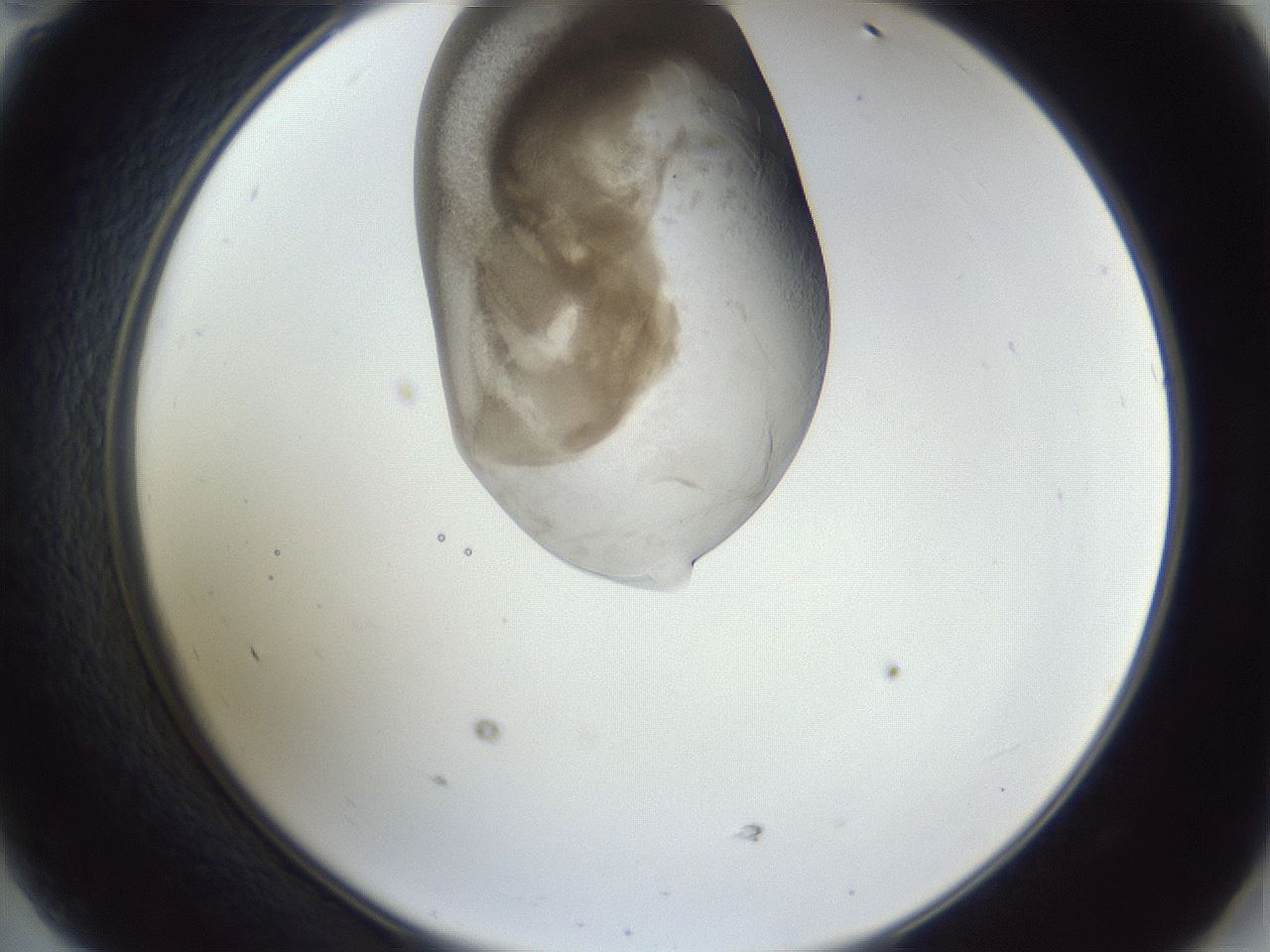 folderID163_plateID1163_batchID3206_wellNum47_profileID1_d2_r62716_ef.jpg