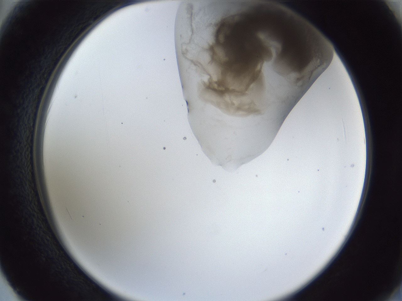 folderID163_plateID1163_batchID3206_wellNum62_profileID1_d2_r62746_ef.jpg
