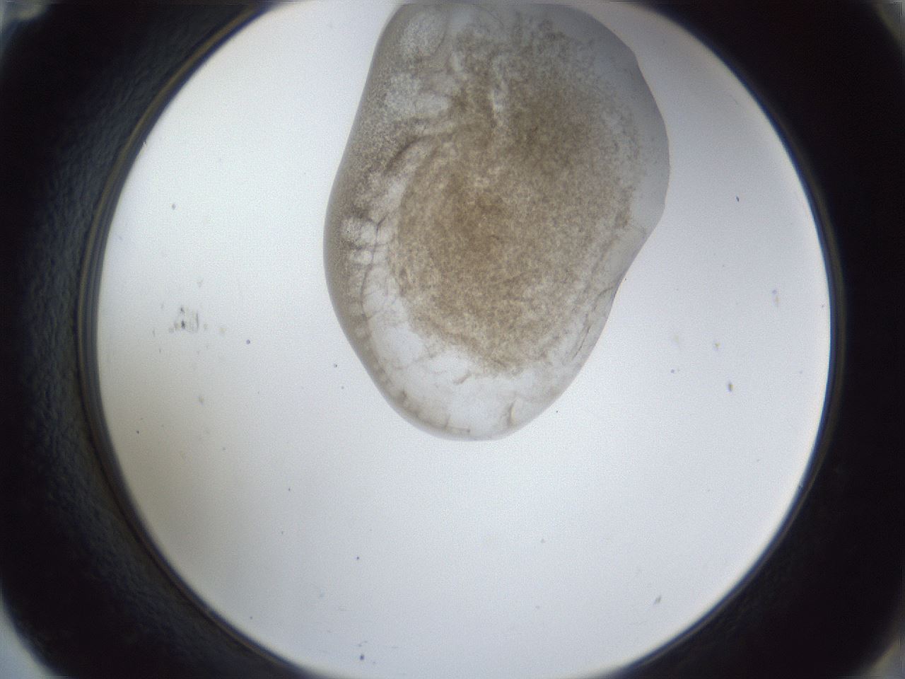 folderID163_plateID1163_batchID3206_wellNum71_profileID1_d2_r62764_ef.jpg