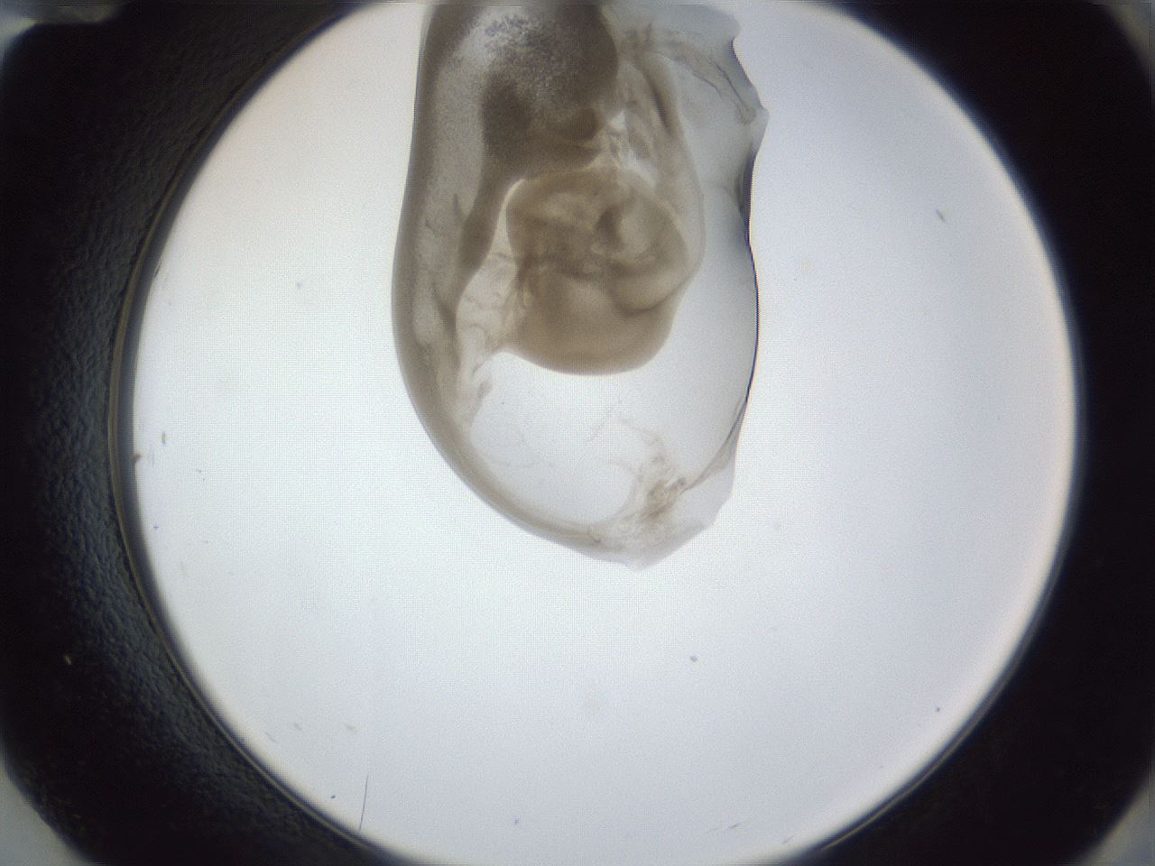 folderID163_plateID1163_batchID3206_wellNum84_profileID1_d2_r62790_ef.jpg