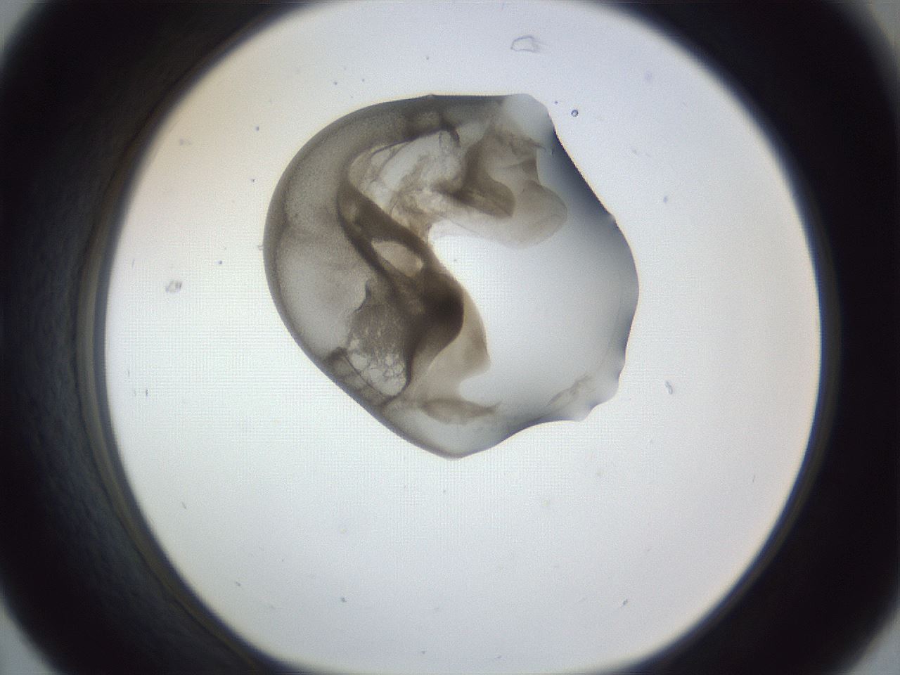 folderID164_plateID1164_batchID3211_wellNum31_profileID1_d1_r63835_ef.jpg