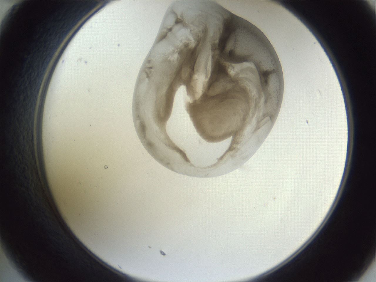 folderID164_plateID1164_batchID3211_wellNum35_profileID1_d2_r63844_ef.jpg